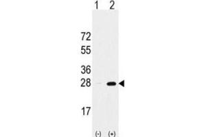 Western Blotting (WB) image for anti-Proteasome Subunit alpha 5 (PSMA5) antibody (ABIN2998030) (PSMA5 antibody)
