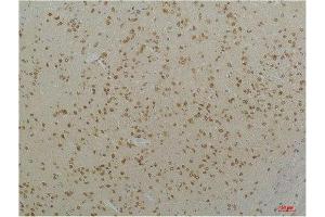 Immunohistochemistry (IHC) image for anti-Calcium Channel, Voltage-Dependent, L Type, alpha 1C Subunit (CACNA1C) antibody (ABIN3181659)