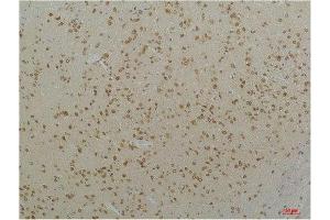 Immunohistochemistry (IHC) analysis of paraffin-embedded Mouse Brain Tissue using Cav1. (CACNA1C antibody)