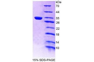 SDS-PAGE (SDS) image for Low Density Lipoprotein Receptor (LDLR) (AA 497-742) protein (His tag) (ABIN2125715) (LDLR Protein (AA 497-742) (His tag))