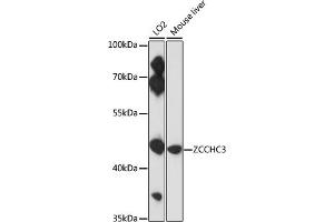 Western blot analysis of extracts of various cell lines, using ZCCHC3 antibody (ABIN7271543) at 1:3000 dilution. (ZCCHC3 antibody  (AA 215-335))