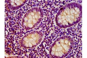 IHC image of ABIN7172046 diluted at 1:400 and staining in paraffin-embedded human appendix tissue performed on a Leica BondTM system. (TST antibody  (AA 2-297))