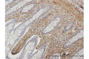 Immunoperoxidase of purified MaxPab antibody to CALD1 on formalin-fixed paraffin-embedded human small Intestine. (Caldesmon antibody  (AA 1-538))