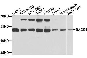 Western blot analysis of extracts of various cell lines, using BACE1 antibody. (BACE1 antibody  (AA 22-322))