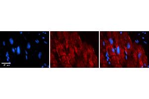 Rabbit Anti-AKAP7 Antibody    Formalin Fixed Paraffin Embedded Tissue: Human Adult heart  Observed Staining: Membrane, Cytoplasmic Primary Antibody Concentration: 1:600 Secondary Antibody: Donkey anti-Rabbit-Cy2/3 Secondary Antibody Concentration: 1:200 Magnification: 20X Exposure Time: 0. (AKAP7 antibody  (Middle Region))