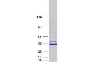 Validation with Western Blot