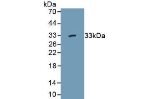 Detection of Recombinant DARS2, Mouse using Polyclonal Antibody to Aspartyl tRNA Synthetase 2, Mitochondrial (DARS2) (DARS2 antibody  (AA 390-653))