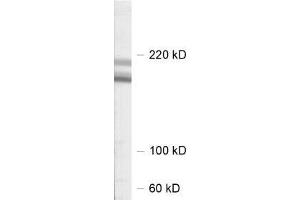 dilution: 1 : 1000, sample: rat hippocampus homogenate (SHANK2 antibody  (AA 1042-1475))