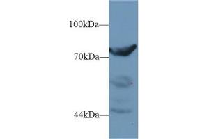 Detection of DPP3 in Rat Placenta lysate using Polyclonal Antibody to Dipeptidyl Peptidase 3 (DPP3) (DPP3 antibody  (AA 2-261))