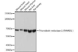 Western blot analysis of extracts of various cell lines, using Thioredoxin reductase 1 (Thioredoxin reductase 1 (TXNRD1 ) ) Rabbit mAb (ABIN7270805) at 1:1000 dilution.