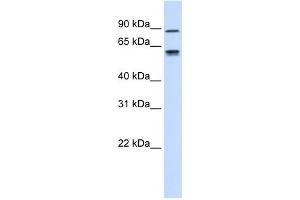 WB Suggested Anti-EFEMP1 Antibody Titration:  0. (FBLN3 antibody  (Middle Region))