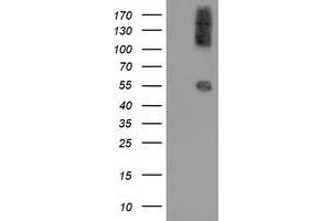 Western Blotting (WB) image for anti-Calcium Binding and Coiled-Coil Domain 2 (CALCOCO2) antibody (ABIN1497078)