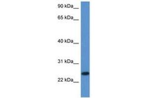 Image no. 1 for anti-Chromosome 1 Open Reading Frame 93 (C1orf93) (AA 96-145) antibody (ABIN6747236) (C1orf93 antibody  (AA 96-145))