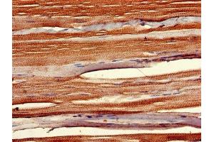 IHC image of ABIN7155848 diluted at 1:400 and staining in paraffin-embedded human skeletal muscle tissue performed on a Leica BondTM system. (SIX Homeobox 1 antibody  (AA 144-262))