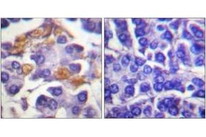 Immunohistochemistry analysis of paraffin-embedded human pancreas, using C-RAF (Phospho-Tyr341) Antibody.