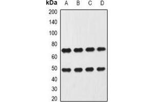 Western blot analysis of Heparanase expression in Hela (A), MCF7 (B), mouse liver (C), mouse lung (D) whole cell lysates. (HPSE antibody)