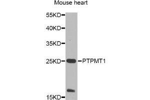 Western blot analysis of extracts of mouse heart, using PTPMT1 Antibody (ABIN5995759) at 1/1000 dilution.