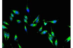 Immunofluorescent analysis of Hela cells using ABIN7142915 at dilution of 1:100 and Alexa Fluor 488-congugated AffiniPure Goat Anti-Rabbit IgG(H+L) (AKAP9 antibody  (AA 71-191))