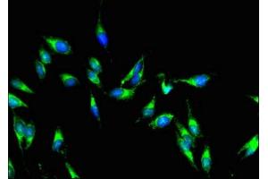 Immunofluorescent analysis of Hela cells using ABIN7142915 at dilution of 1:100 and Alexa Fluor 488-congugated AffiniPure Goat Anti-Rabbit IgG(H+L)