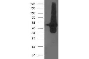 HEK293T cells were transfected with the pCMV6-ENTRY control (Left lane) or pCMV6-ENTRY DOK2 (Right lane) cDNA for 48 hrs and lysed. (DOK2 antibody)