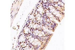 Immunohistochemistry (Paraffin-embedded Sections) (IHC (p)) image for anti-DMRT-Like Family A2 (DMRTA2) antibody (ABIN7073753)