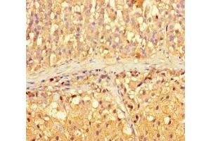 Immunohistochemistry of paraffin-embedded human adrenal gland tissue using ABIN7143489 at dilution of 1:100 (ARL16 antibody  (AA 1-197))