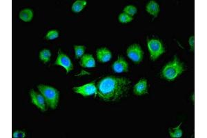 Immunofluorescent analysis of MCF-7 cells using ABIN7165150 at dilution of 1:100 and Alexa Fluor 488-congugated AffiniPure Goat Anti-Rabbit IgG(H+L) (BUD31 antibody  (AA 1-144))