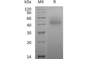 Western Blotting (WB) image for CD86 (CD86) protein (His tag) (ABIN7320993) (CD86 Protein (CD86) (His tag))