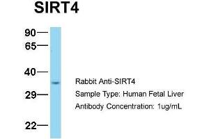 Host:  Rabbit  Target Name:  SIRT4  Sample Type:  Human Fetal Liver  Antibody Dilution:  1. (SIRT4 antibody  (N-Term))