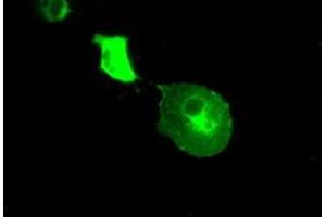 Image no. 4 for anti-Crystallin, alpha B (CRYAB) antibody (ABIN1497641) (CRYAB antibody)