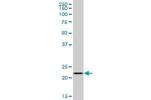 FKBP11 MaxPab polyclonal antibody. (FKBP11 antibody  (AA 1-201))