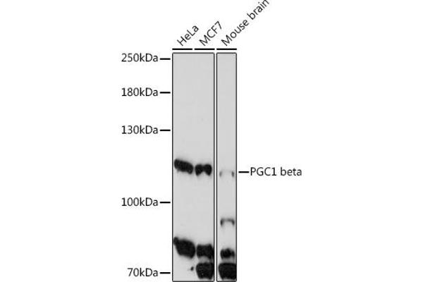 PPARGC1B antibody  (AA 850-950)