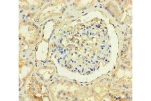 Immunohistochemistry of paraffin-embedded human kidney tissue using ABIN7173277 at dilution of 1:100