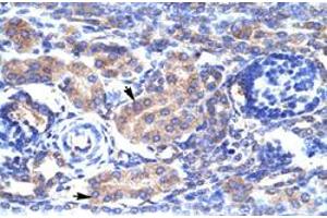 Immunohistochemical staining (Formalin-fixed paraffin-embedded sections) of human kidney with KCNAB3 polyclonal antibody  at 4-8 ug/mL working concentration. (KCNAB3 antibody  (N-Term))