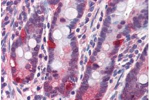 Human Small Intestine (formalin-fixed, paraffin-embedded) stained with NOD2 antibody ABIN351444 at 3 ug/ml followed by biotinylated goat anti-rabbit IgG secondary antibody ABIN481713, alkaline phosphatase-streptavidin and chromogen. (NOD2 antibody  (C-Term))