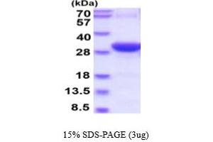 SDS-PAGE (SDS) image for Synaptotagmin I (SYT1) (AA 136-382) protein (His tag) (ABIN6386765) (SYT1 Protein (AA 136-382) (His tag))
