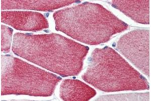 Human Skeletal Muscle: Formalin-Fixed, Paraffin-Embedded (FFPE) (CASQ2 antibody  (AA 20-400))