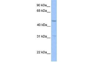 Human HepG2; WB Suggested Anti-ZNF342 Antibody Titration: 0. (Zinc Finger Protein 296 (ZNF296) (Middle Region) antibody)