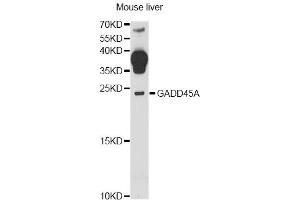 Western blot analysis of extracts of mouse liver, using GADD45A antibody (ABIN6292100) at 1:1000 dilution. (GADD45A antibody)