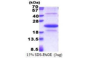 SDS-PAGE (SDS) image for Ectodysplasin A2 Receptor (EDA2R) (AA 1-138) protein (His tag) (ABIN5853331) (Ectodysplasin A2 Receptor Protein (EDA2R) (AA 1-138) (His tag))