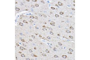Immunohistochemistry of paraffin-embedded rat brain using PTPN23 Rabbit pAb (ABIN1682396, ABIN3019081, ABIN3019082 and ABIN6220704) at dilution of 1:100 (40x lens). (PTPN23 antibody  (AA 1230-1450))