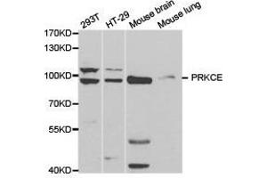 Western Blotting (WB) image for anti-Protein Kinase C, epsilon (PRKCE) antibody (ABIN1874300) (PKC epsilon antibody)