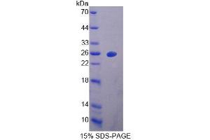 SDS-PAGE of Protein Standard from the Kit (Highly purified E. (Vitamin D-Binding Protein CLIA Kit)