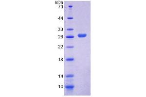 SDS-PAGE (SDS) image for Low Density Lipoprotein Receptor-Related Protein 1B (LRP1B) (AA 31-194) protein (His tag) (ABIN6239247) (LRP1B Protein (AA 31-194) (His tag))