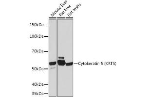 Western blot analysis of extracts of various cell lines, using Cytokeratin 5 (KRT5) (KRT5) Rabbit mAb (ABIN7268103) at 1:1000 dilution. (Cytokeratin 5 antibody)