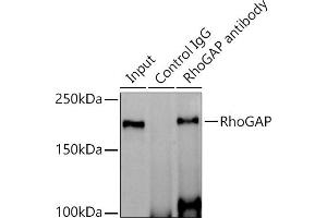 Immunoprecipitation analysis of 600 μg extracts of Mouse brain cells using 3 μg RhoGAP antibody (ABIN1682830, ABIN3016006, ABIN3016007 and ABIN7101474).