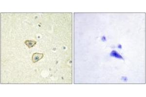 Immunohistochemistry analysis of paraffin-embedded human brain tissue, using EGFR (Ab-1016) Antibody. (EGFR antibody  (AA 986-1035))