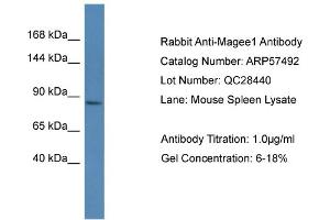 Western Blotting (WB) image for anti-Melanoma Antigen Family E, 1 (MAGEE1) (C-Term) antibody (ABIN2787243) (MAGEE1 antibody  (C-Term))