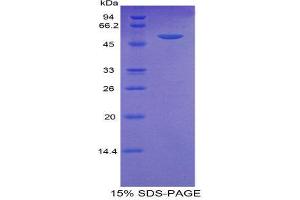 SDS-PAGE (SDS) image for Trefoil Factor 3 (Intestinal) (TFF3) (AA 22-80) protein (His tag,MBP tag) (ABIN2123801)