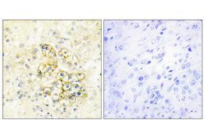 Immunohistochemistry (IHC) image for anti-Prostate Transmembrane Protein, Androgen Induced 1 (PMEPA1) (Internal Region) antibody (ABIN1849882) (PMEPA1 antibody  (Internal Region))